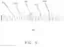 Fig. 12 - Pulmonary Artery Pressure Signals And Methods of Using