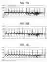 Fig. 06 - Method of compressing electrocardiogram data and electrocardiogram telemetry system using the same