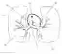 Fig. 01 - Pulmonary Artery Pressure Signals And Methods of Using
