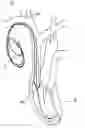Fig. 01 - Medical Device