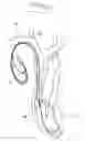 Fig. 02 - Medical Device
