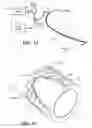 Fig. 02 - MULTIFUNCTION CANNULA TOOLS