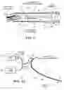 Fig. 03 - Catheter with imaging capability acts as guidewire for cannula tools