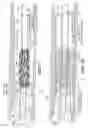 Fig. 08 - Catheter with imaging capability acts as guidewire for cannula tools