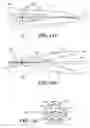 Fig. 15 - Catheter with imaging capability acts as guidewire for cannula tools