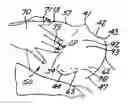 Fig. 01 - Body decompression technique for pain treatment