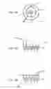 Fig. 16 - INTERCHANGEABLE HIGH INTENSITY FOCUSED ULTRASOUND TRANSDUCER