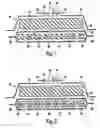 Fig. 02 - Abdominal wound dressing