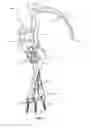 Fig. 05 - Guide and method for inserting an elongated member into a patient