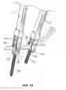 Fig. 07 - Guide and method for inserting an elongated member into a patient