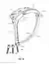 Fig. 12 - Guide and method for inserting an elongated member into a patient