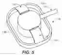 Fig. 04 - METHOD FOR INSERTING A CANNULA INTO AN INFUSION SITE