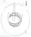 Fig. 05 - METHOD FOR INSERTING A CANNULA INTO AN INFUSION SITE