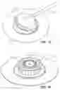 Fig. 11 - METHOD FOR INSERTING A CANNULA INTO AN INFUSION SITE