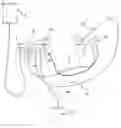 Fig. 01 - Method and device for irrigation of body cavities