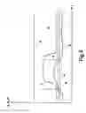 Fig. 06 - Method and device for irrigation of body cavities