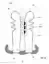 Fig. 23 - Controllable release nasal system
