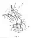 Fig. 02 - Breast pump