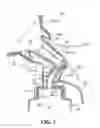 Fig. 05 - Breast pump