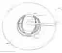 Fig. 01 - INFUSION SET KIT