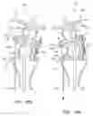 Fig. 114 - SUPPORT STRUCTURE FOR ROBOTIC MEDICAL INSTRUMENT