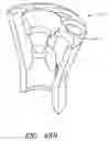 Fig. 119 - SUPPORT STRUCTURE FOR ROBOTIC MEDICAL INSTRUMENT