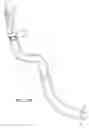 Fig. 87 - SUPPORT STRUCTURE FOR ROBOTIC MEDICAL INSTRUMENT