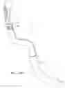 Fig. 92 - SUPPORT STRUCTURE FOR ROBOTIC MEDICAL INSTRUMENT