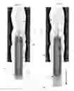 Fig. 04 - METHODS AND APPARATUS FOR TREATMENT OF VENOUS INSUFFICIENCY