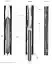Fig. 05 - METHODS AND APPARATUS FOR TREATMENT OF VENOUS INSUFFICIENCY
