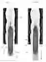 Fig. 12 - METHODS AND APPARATUS FOR TREATMENT OF VENOUS INSUFFICIENCY
