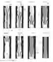 Fig. 19 - METHODS AND APPARATUS FOR TREATMENT OF VENOUS INSUFFICIENCY
