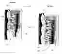 Fig. 24 - METHODS AND APPARATUS FOR TREATMENT OF VENOUS INSUFFICIENCY