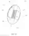 Fig. 11 - Intragastric balloon system and therapeutic processes and products