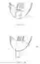 Fig. 12 - Intragastric balloon system and therapeutic processes and products