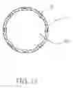Fig. 14 - Intragastric balloon system and therapeutic processes and products