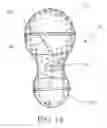 Fig. 15 - Intragastric balloon system and therapeutic processes and products
