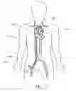 Fig. 03 - Expandable trans-septal sheath
