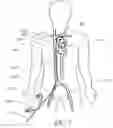 Fig. 04 - Expandable trans-septal sheath