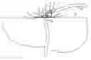 Fig. 01 - System for surgical drain fixation
