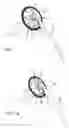 Fig. 02 - System for surgical drain fixation