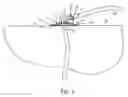 Fig. 04 - System for surgical drain fixation