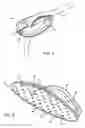 Fig. 06 - System for surgical drain fixation