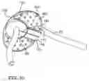 Fig. 10 - System for surgical drain fixation