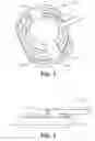 Fig. 02 - USER-RELEASABLE SIDE-ATTACH ROTARY INFUSION SET