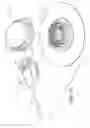 Fig. 16 - USER-RELEASABLE SIDE-ATTACH ROTARY INFUSION SET