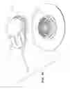 Fig. 17 - USER-RELEASABLE SIDE-ATTACH ROTARY INFUSION SET