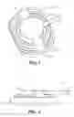 Fig. 02 - METHOD FOR MOUNTING A USER RELEASABLE SIDE-ATTACH ROTARY INFUSION SET TO AN INFUSION SITE