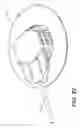 Fig. 15 - METHOD FOR MOUNTING A USER RELEASABLE SIDE-ATTACH ROTARY INFUSION SET TO AN INFUSION SITE