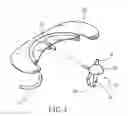 Fig. 04 - Nozzle assembly for enema kit